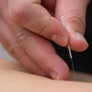 Accurate Acupuncture by Remington Zhang - Back Care Products & Services