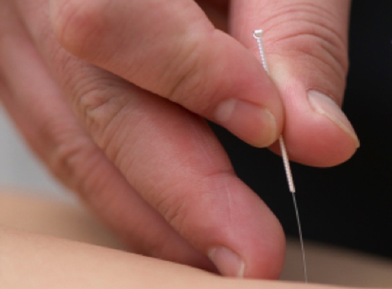 Accurate Acupuncture by Remington Zhang - Hilliard, OH