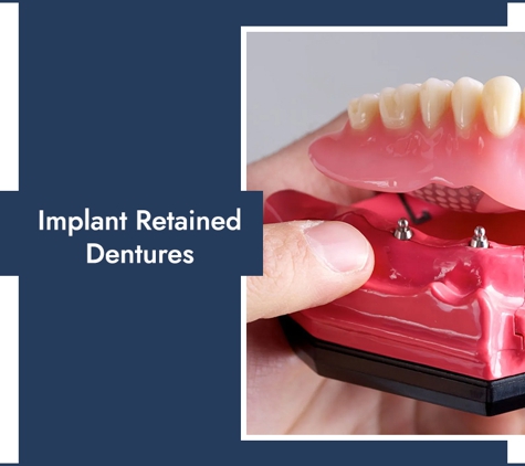 Right Dentures - Wanniassa, ACT. Implant Retained Dentures