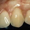 Santa Rosa Dental Implant Center - Periodontists