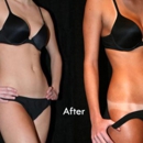 Mobile Spray Tanning Rose to the Occasion - Tanning Salons