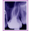 Pinole Endodontics gallery