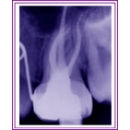 Pinole Endodontics - Endodontists