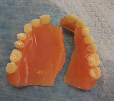 Denture Repairs by Lori - San Diego, CA