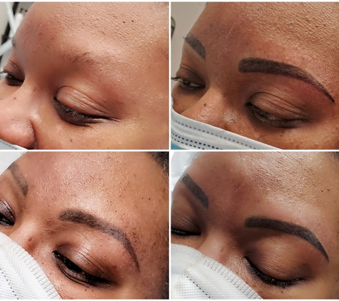 Advanced Esthetics Beauty Forever - Kenosha, WI