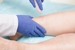 Coastal Vascular Center - Physicians & Surgeons, Vascular Surgery