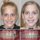 Horner Barrow Orthodontics PC - Orthodontists