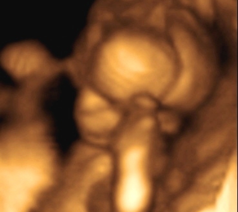 TLC Imaging 3D/4D Ultrasounds - Reynoldsburg, OH