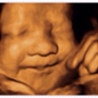 4D Moments Ultrasound LLC