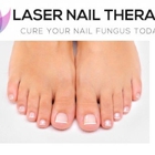 Laser Nail Therapy- Largest Toenail Fungus Treatment Center