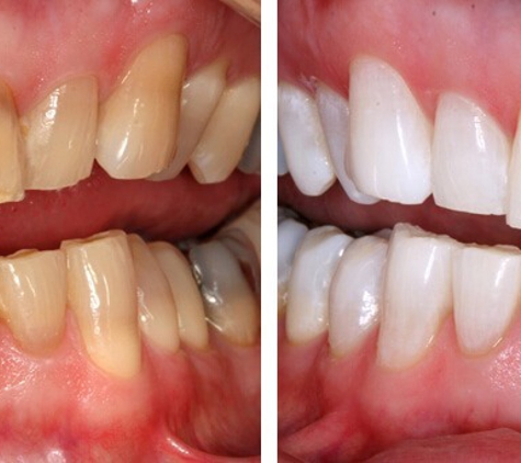 URBN Dental Implants & Invisalign - Spring Branch - Houston, TX