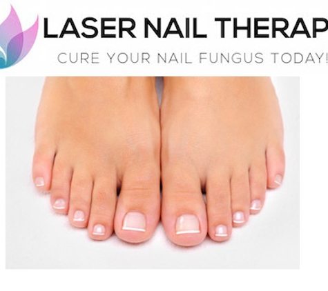 Laser Nail Therapy Clinic - San Jose, CA