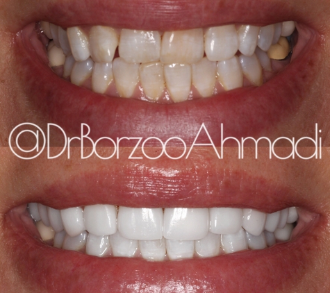 Dr. Borzoo Ahmadi DDS - West Hollywood, CA