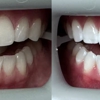 Martinson Family and Cosmetic Dentistry gallery