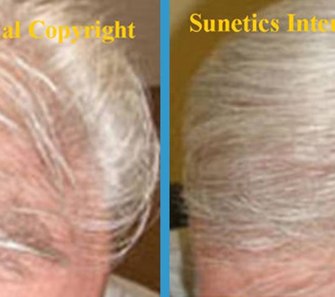 Hair Growth Clinic of CT - Fairfield, CT