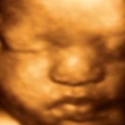 1st Glimpse Inc. 3D/4D Ultrasound