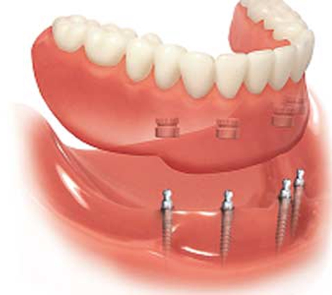 Cronulla Denture Care