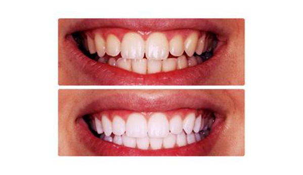 Metro Dental Care - Mawson Lakes, SA
