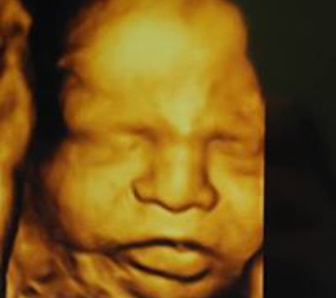 Peek Of Joy 3D Ultrasound & Spa - Williamsburg, VA