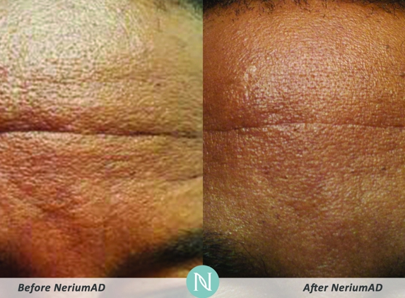 Nerium International - Team Pratt - Orlando, FL