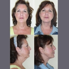 The Brandow Clinic Plastic Surgery - Kirk Brandow, MD