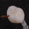 Advadent Dental Laboratory gallery