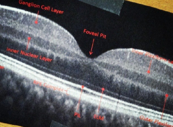 Glaucoma Center of San Francisco - San Francisco, CA