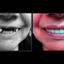 North Easton Dental Associates - Implant Dentistry