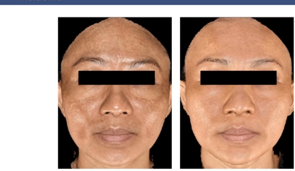Clean Laser Clinics - Teneriffe, QLD