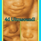 Hi Mommy  4d Ultrasound !!!!