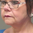 Dakota Plastic Surgery - Physicians & Surgeons, Plastic & Reconstructive