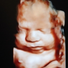 Bundle of Love 3D/4D 5D HDLive Ultrasound & Baby Boutique