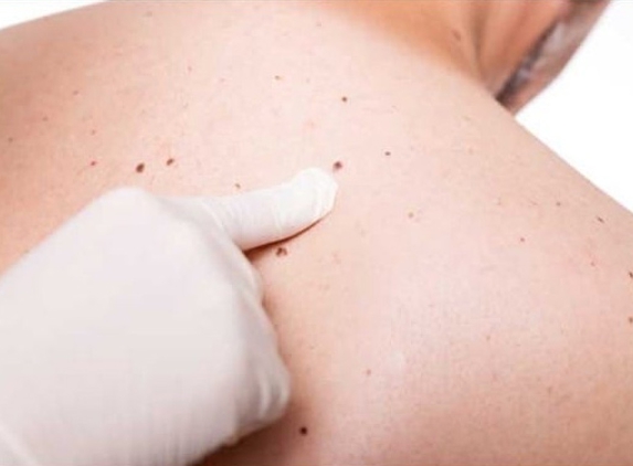 Icarus Skin Cancer Clinic - Koo Wee Rup, VIC