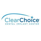 Clearchoice Dental Implants