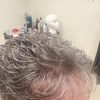 Hair Replacement Associates gallery