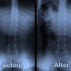 Spinal Health and Correction Center