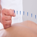 BIS-MAN Chiropractic & Acupuncture - Acupuncture