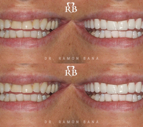 Ramon Bana DDS - Coral Gables, FL