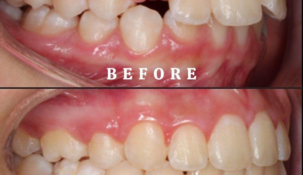 Super Orthodontics - Encino, CA