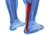 Deniel Foot and Ankle Center - Physicians & Surgeons, Podiatrists
