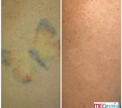 MEDermis Laser Clinic - San Antonio, TX