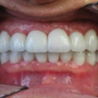 A-Implant Dental Lab Inc