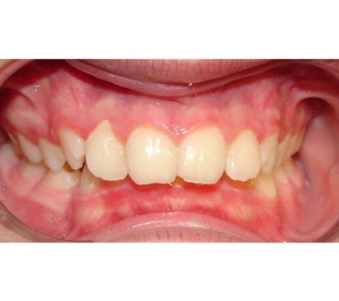 Active Orthodontics - Bundaberg South, QLD
