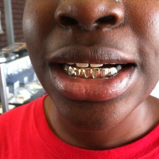 Gold Teeth Specialists - Louisville, KY