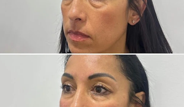 BeautyFULL Cosmetic Medical Clinic - Kingscliff, NSW