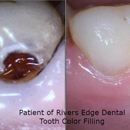 Rivers Edge Dental - Dentists