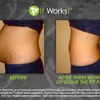 It Works! Body Wraps Newport News gallery