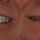 Mclean Aura Dentistry - Implant Dentistry
