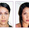 Ruth Swissa Professional Permanent Makeup and Skin gallery