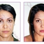Ruth Swissa Professional Permanent Makeup and Skin